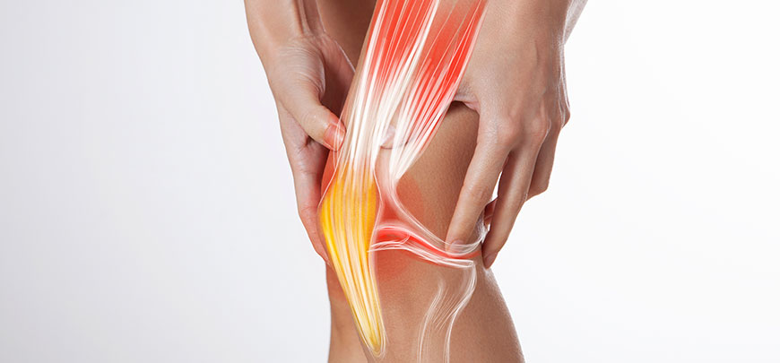 patient needing ligamentitis treatment in Sacramento