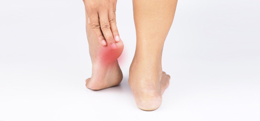 patient receiving plantar fasciitis in Sacramento