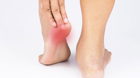 patient requiring plantar fasciitis treatment in Sacramento
